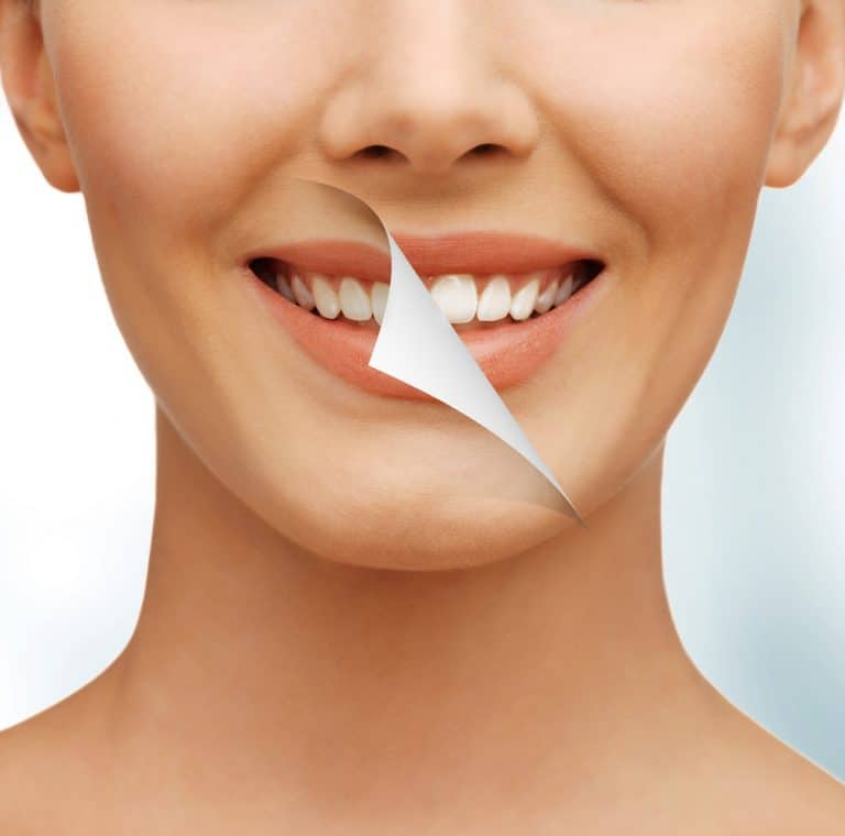 Teeth Cleaning Davie Florida